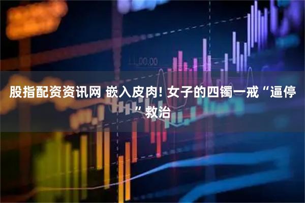 股指配资资讯网 嵌入皮肉! 女子的四镯一戒“逼停”救治
